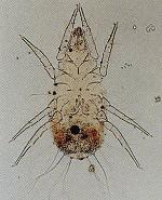 ケナガコナダニの画像